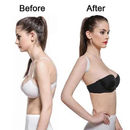 Invisible Back Posture Corrector Belt